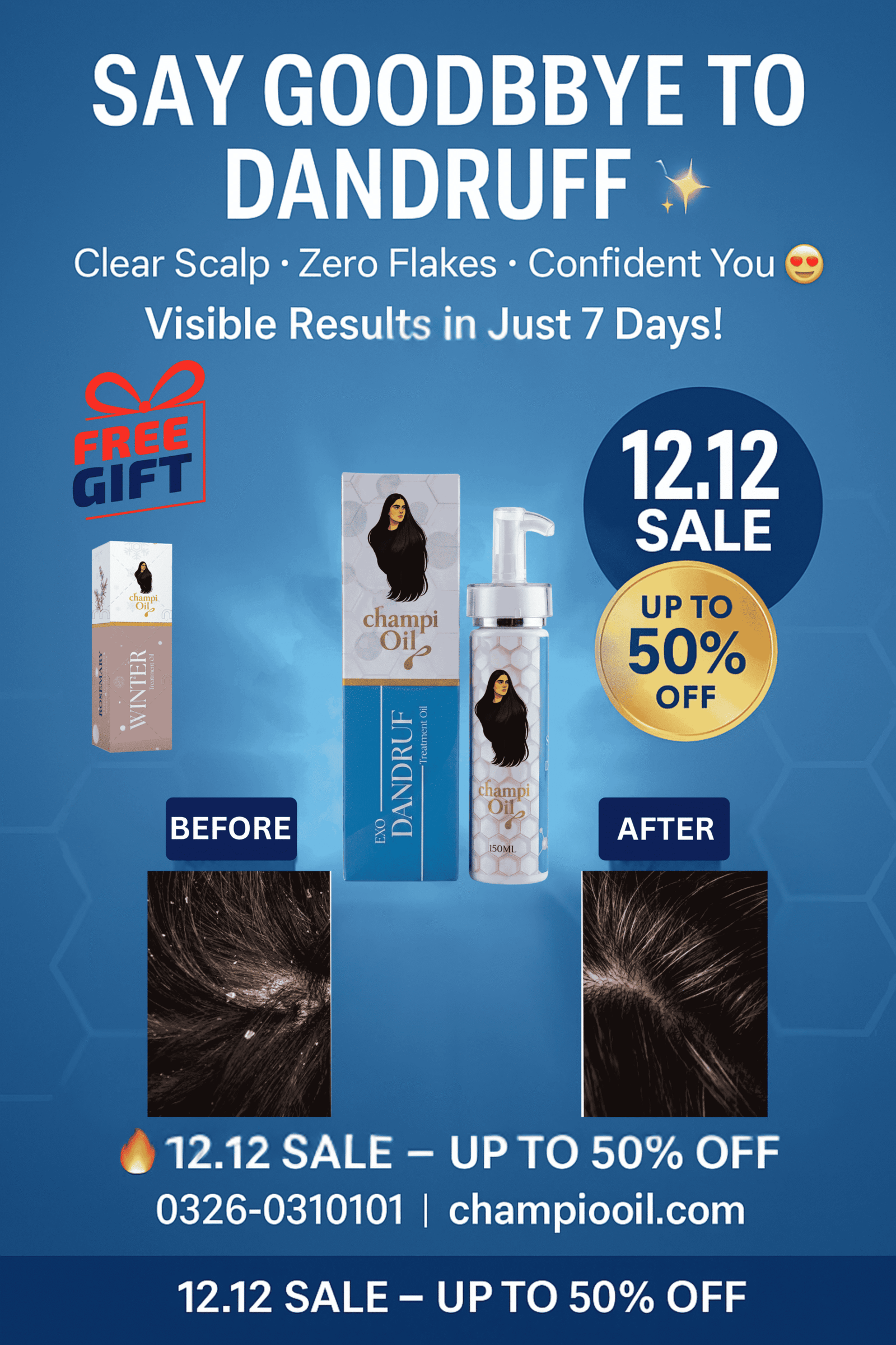 Exo-dandruff treatment oil